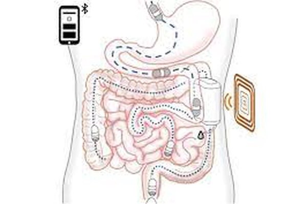 robot-insulina-sin-agujas-sistema-robotico