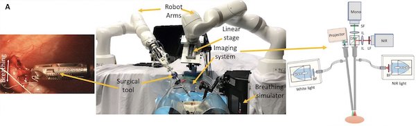 robot-laparoscopia-autónomo